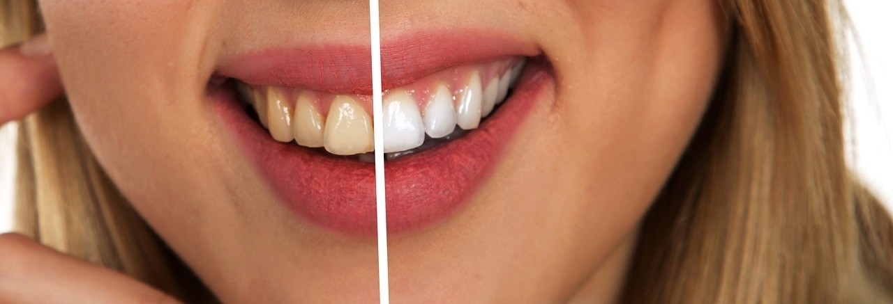 is nicotine gum bad for your teeth